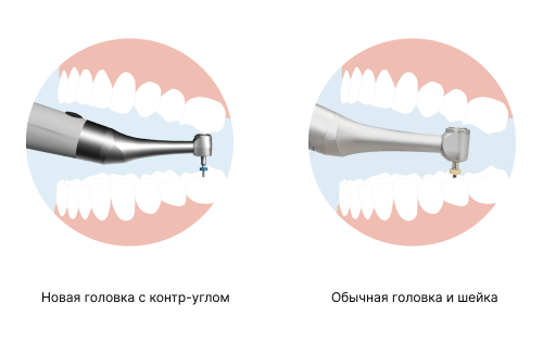 Бесщёточный мотор (1).png