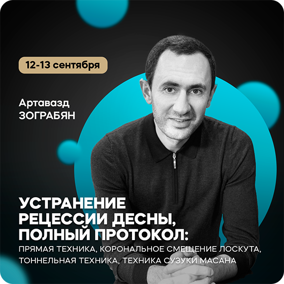 рецессия десны.png