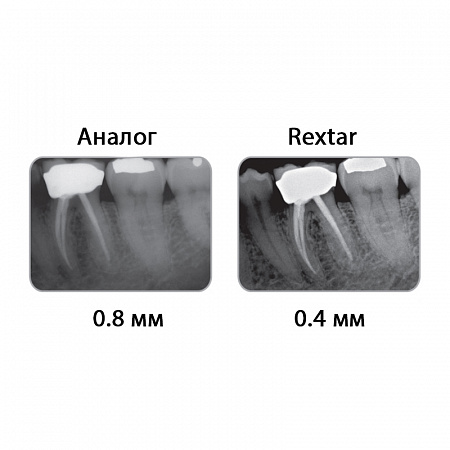 POSDION Rextar - портативный рентген